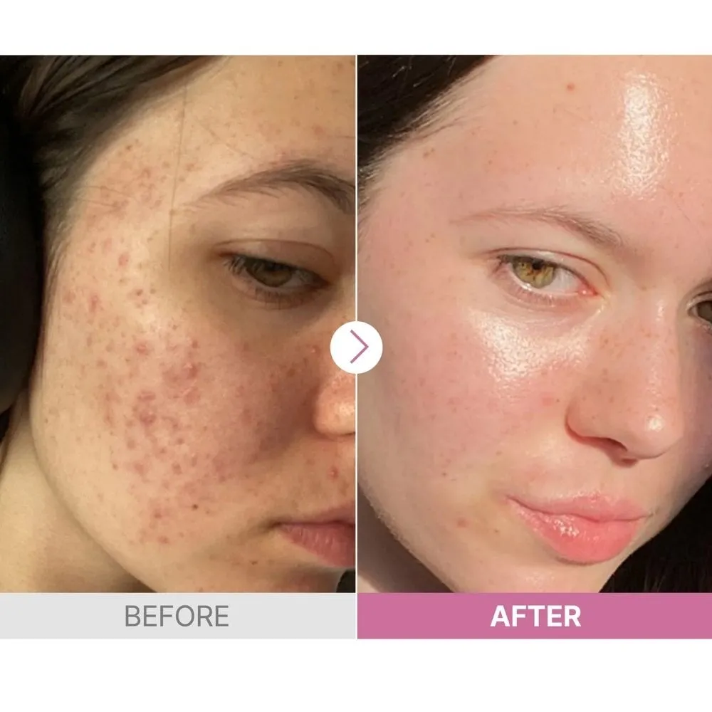CosRx The Niacinamide 15 Serum 20g